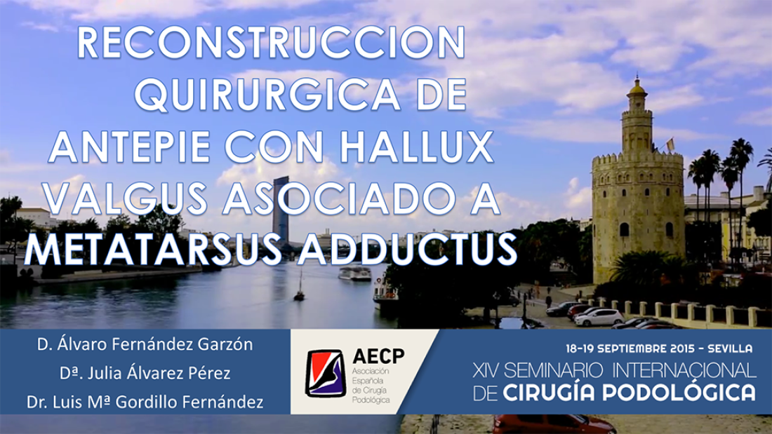 Reconstruccion quirurgica de antepie